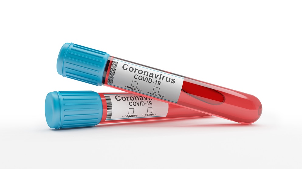 Illustation von zwei auf Coronavirus getesteten Blutentnahmeröhrchen vor weißem Hintergrund.  | Bildquelle: stock.adobe.com/marog-pixcells