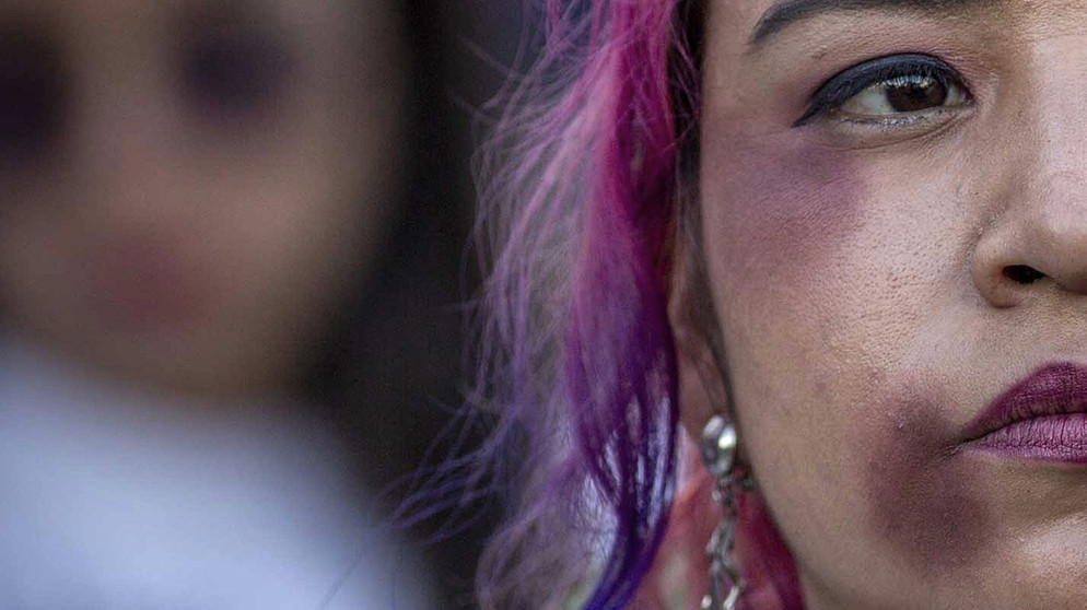 ARCHIV - 26.11.2018, Mexiko, Mexiko-Stadt: Eine Frau mit blauen Flecken am Gesicht nimmt an einem Protest gegen Gewalt an Frauen teil. Am Internationalen Tag gegen Gewalt an Frauen haben Politiker und Fraktionen vor den Gefahren gewarnt, die im Zuge der Corona-Pandemie entstanden sind. Foto: Jair Cabrera/Zuma Press/dpa +++ dpa-Bildfunk +++ | Bildquelle: dpa-Bildfunk/Jair Cabrera