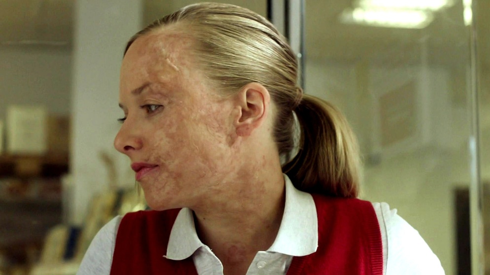 Haut | Bildquelle: www.elfenholzfilm.de