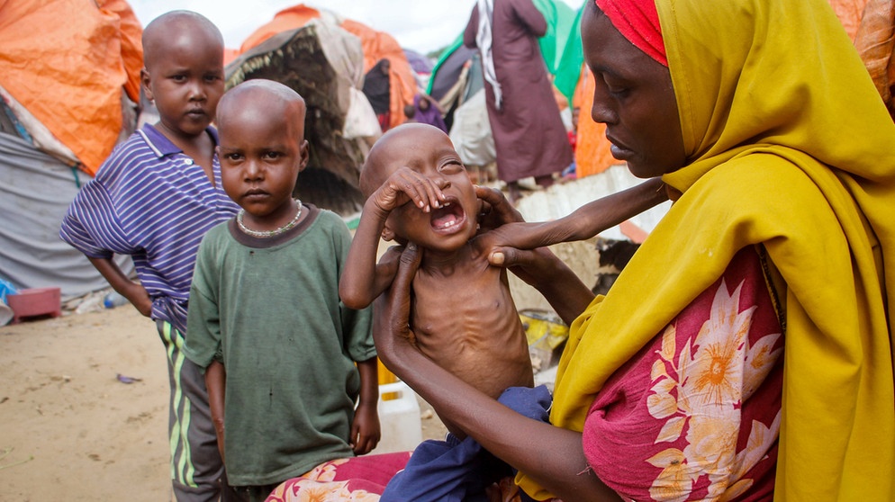 Somalia, Mogadischu: Maryan Madey, die aus der von Dürre heimgesuchten Region Lower Shabelle geflohen ist, hält ihre unterernährte Tochter Deka Ali (1) in einem Lager für Vertriebene am Stadtrand. Unsere andauernde Abhängigkeit von Kohle, Gas und Erdöl beschleunigt nicht nur die Klimakrise: Sie verschärft auch die gesundheitlichen Folgen, die mit Erderwärmung, Luftverschmutzung und Extremwetterereignissen einhergehen.  | Bildquelle: dpa-Bildfunk/Farah Abdi Warsameh