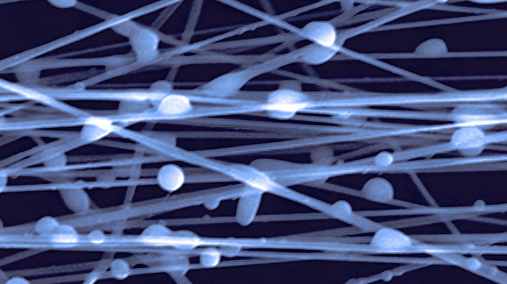Researchers at the Midwest Cancer Nanotechnology Training Center (M-CNTC) have developed a blood clot-mimicking patch capable of delivering therapeutic drugs to an implantation site in a controllable manner. This image shows the 2 to 6 micron thick drug releasing microparticles attached to the directionally aligned 1 micron thick microfibers on the patch. | Bildquelle: picture alliance / BSIP | NIH / IMAGE POINT FR