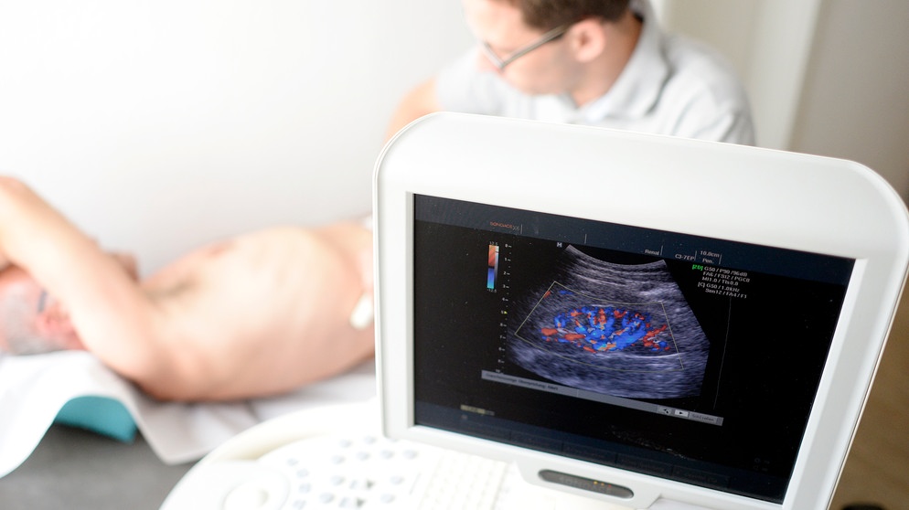 Ein Arzt untersucht die Nieren eines Patienten mittels Ultraschall. | Bildquelle: picture-alliance/dpa