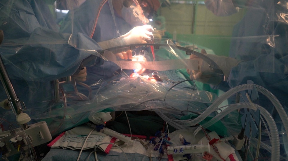Organspende | Bildquelle: BR