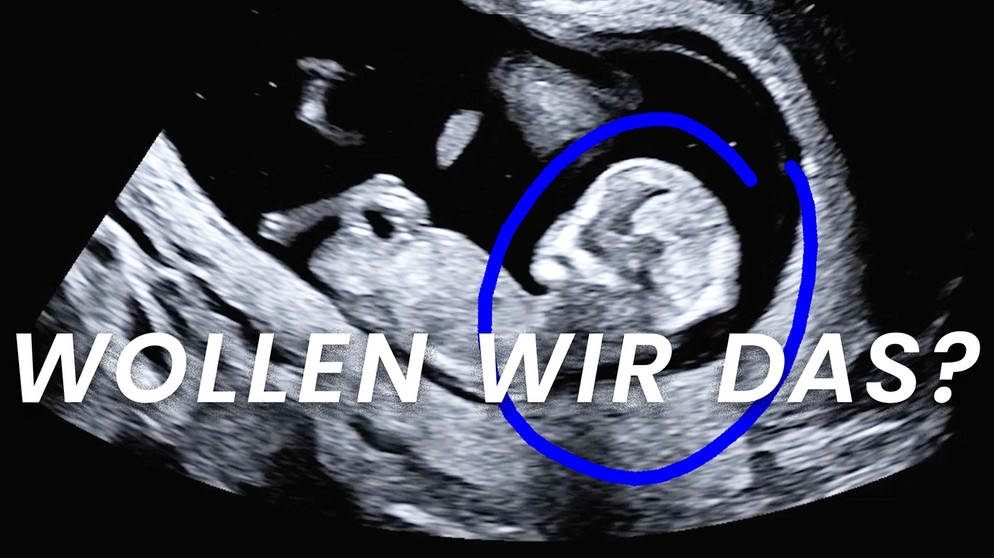 Pränataldiagnostik - Wie uns das Wissen verändert | Bildquelle: BR