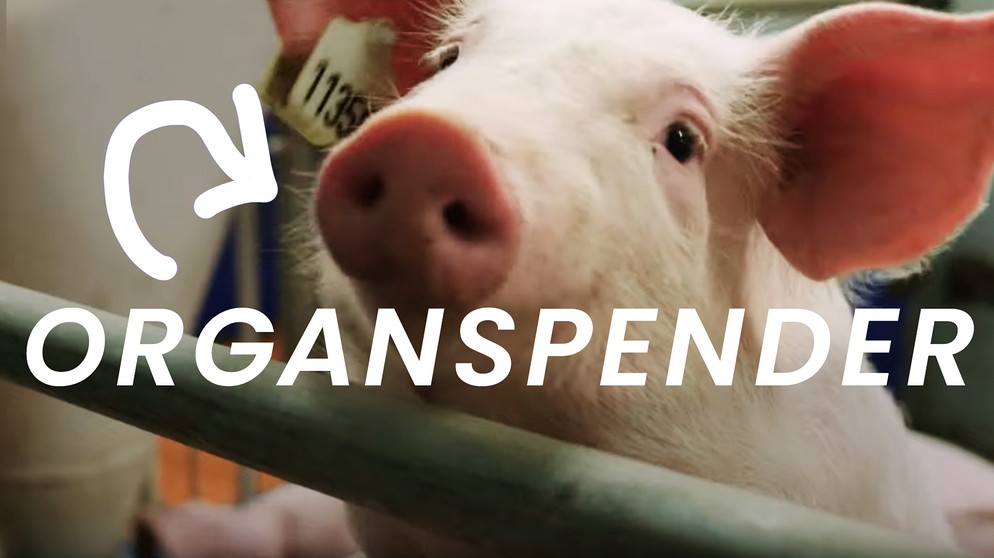 Xenotransplantation - Wie Tiere zum Organspender für Menschen werden können. | Bildquelle: BR