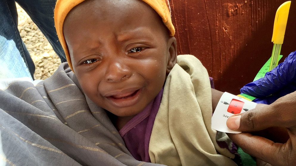 Ein Mitarbeiter einer Klinik in Baidoa in Südwestsomalia misst den Armumfang des kleinen Rachid. Das Baby ist schwer unterernährt und braucht dringend Spezialnahrung.  | Bildquelle: dpa-Bildfunk/Eva-Maria Krafczyk